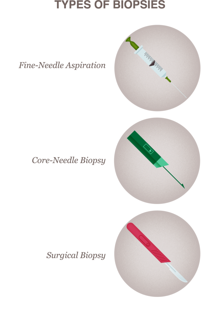 breast-biopsy-procedure-types-what-to-expect-results-guide