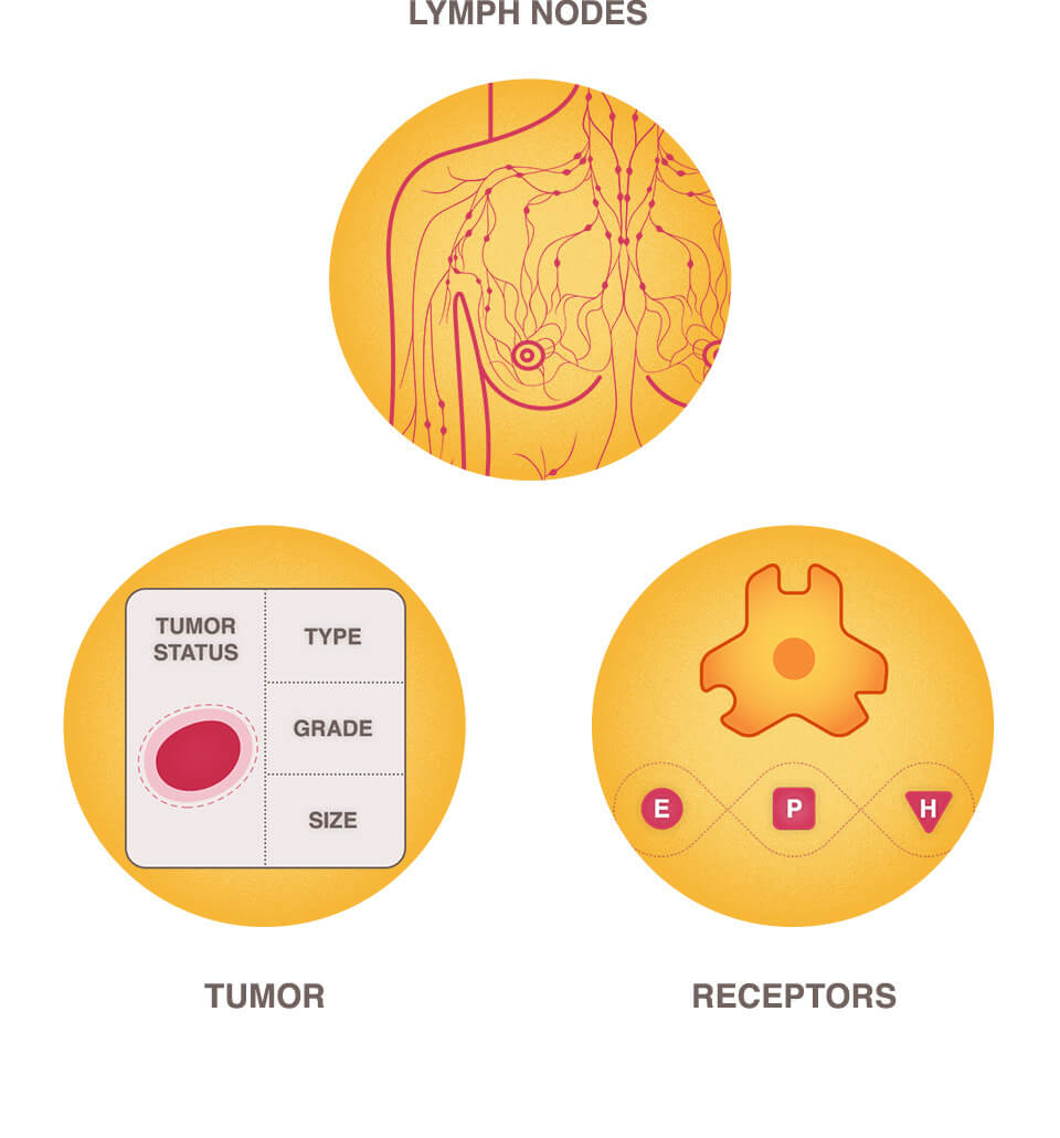 chemotherapy-national-breast-cancer-foundation